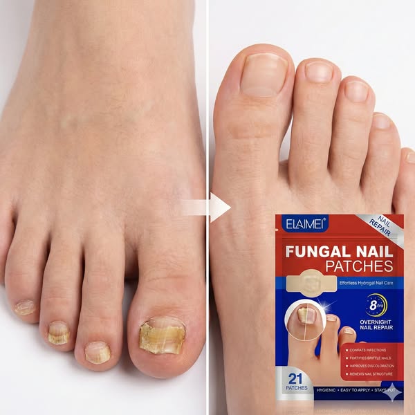 FUNGAL NAIL PATCHES