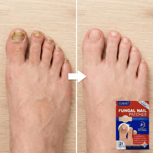 FUNGAL NAIL PATCHES